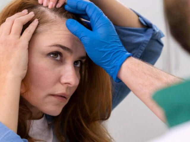 What You Need to Know Before Starting a Hair Restoration Program
